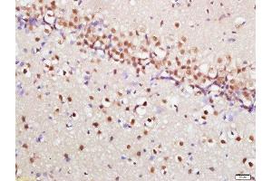 Paraformaldehyde-fixed, paraffin embedded rat brain, Antigen retrieval by boiling in sodium citrate buffer (pH6) for 15min, Block endogenous peroxidase by 3% hydrogen peroxide for 30 minutes, Blocking buffer (normal goat serum) at 37°C for 20min, Antibody incubation with mTOR (Ser2448) Polyclonal Antibody, Unconjugated  at 1:200 overnight at 4°C, followed by a conjugated secondary and DAB staining. (MTOR antibody  (pSer2448))