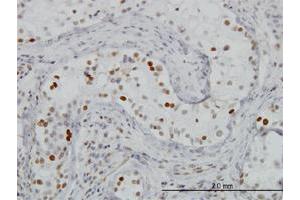 Immunoperoxidase of monoclonal antibody to BRD3 on formalin-fixed paraffin-embedded human testis. (BRD3 antibody  (AA 418-556))