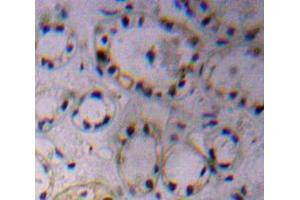 Used in DAB staining on fromalin fixed paraffin-embedded Kidney tissue (ADAM17 antibody  (AA 226-473))