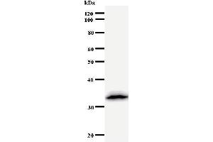 Western Blotting (WB) image for anti-Deoxycytidine Kinase (DCK) antibody (ABIN931037) (DCK antibody)