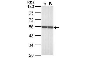 WB Image Sample (30 ug of whole cell lysate) A: A431 , B: H1299 10% SDS PAGE antibody diluted at 1:3000 (ENO1 antibody)