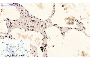 Immunohistochemical analysis of paraffin-embedded human lung tissue. (ERK1/2 antibody  (pTyr205, pTyr222))