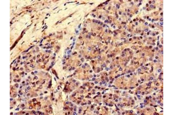 RCOR3 antibody  (AA 1-300)