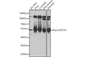 Western blot analysis of extracts of various cell lines, using Fascin/Fascin/FSCN1 antibody (ABIN6131667, ABIN6140779, ABIN6140780 and ABIN6217317) at 1:1000 dilution. (Fascin antibody  (AA 260-380))