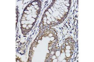 Immunohistochemistry of paraffin-embedded human colon using Fukutin Rabbit mAb (ABIN7267275) at dilution of 1:100 (40x lens).