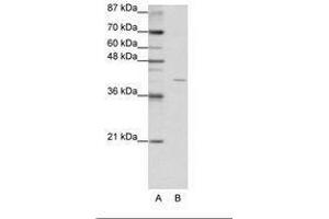Image no. 2 for anti-Eukaryotic Translation Initiation Factor 3, Subunit G (EIF3G) (AA 42-91) antibody (ABIN202234) (EIF3G antibody  (AA 42-91))