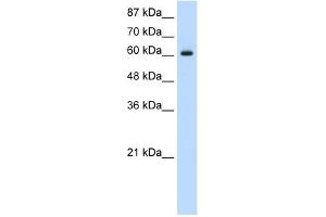 Western Blot showing HIF3A antibody used at a concentration of 1-2 ug/ml to detect its target protein. (HIF3A antibody  (C-Term))