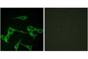Immunofluorescence analysis of LOVO cells, using HRH2 Antibody. (HRH2 antibody  (AA 131-180))