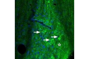 Expression of Adenosine A2A Receptor in mouse diagonal band - Immunohistochemical staining of mouse diagonal band using Anti-Adenosine A2A Receptor Antibody (ABIN7042883, ABIN7043888 and ABIN7043889). (Adenosine A2a Receptor antibody  (AA 201-215))