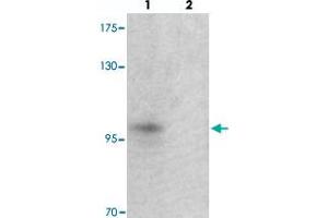 Western blot analysis of TSHZ2 in A-20 cell lysate with TSHZ2 polyclonal antibody  at 1 ug/mL in (lane 1) the absence and (lane 2) the presence of blocking peptide. (TSHZ2 antibody  (N-Term))