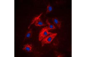 Immunofluorescent analysis of MAST4 staining in HuvEc cells. (MAST4 antibody  (N-Term))