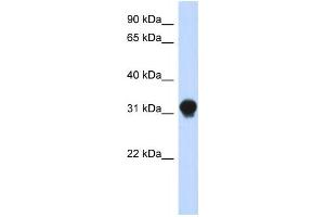 Western Blotting (WB) image for anti-Dynein, Axonemal, Light Intermediate Chain 1 (DNALI1) antibody (ABIN2459694)