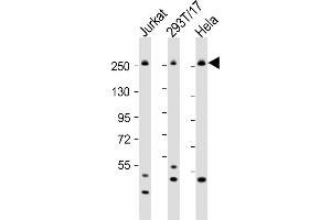 Western Blotting (WB) image for anti-Carbamoyl-Phosphate Synthetase 2, Aspartate Transcarbamylase, and Dihydroorotase (CAD) (AA 780-809) antibody (ABIN655062)