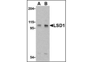 Western blot analysis of LSD1 in P815 cell lysate with this product at (A) 1 and (B) 2 μg/ml. (LSD1 antibody  (Center))