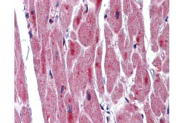 RBM24 antibody  (C-Term)