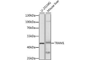 Western blot analysis of extracts of various cell lines, using TR antibody (ABIN7270934) at 1:1000 dilution. (TRAM1 antibody  (AA 305-374))