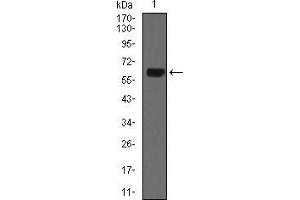 Western blot analysis using CK5 mouse mAb against A431 (1) cell lysate. (Cytokeratin 5 antibody  (AA 316-590))