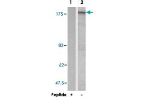 Western blot analysis of extracts from 293 cells using IRS1 polyclonal antibody . (IRS1 antibody)