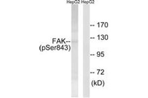 Western blot analysis of extracts from HepG2 cells treated with PMA 125ng/ml 20', using FAK (Phospho-Ser843) Antibody. (FAK antibody  (pSer843))