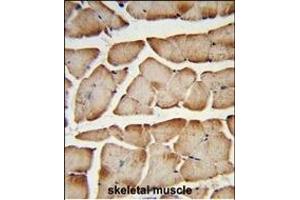 Formalin-fixed and paraffin-embedded human skeletal muscle reacted with T150A Antibody (Center), which was peroxidase-conjugated to the secondary antibody, followed by DAB staining. (TMEM150A antibody  (AA 81-108))