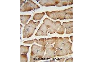 Formalin-fixed and paraffin-embedded human skeletal muscle reacted with T150A Antibody (Center), which was peroxidase-conjugated to the secondary antibody, followed by DAB staining. (TMEM150A antibody  (AA 81-108))