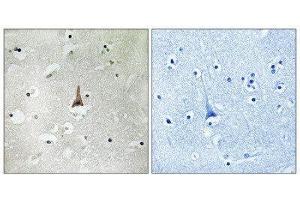 Immunohistochemistry (IHC) image for anti-Low Density Lipoprotein Receptor Related Protein 10 (LRP10) (Internal Region) antibody (ABIN1851502) (LRP10 antibody  (Internal Region))