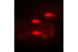 Immunofluorescent analysis of CALCOCO1 staining in A549 cells. (CALCOCO1 antibody)