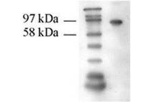 Western Blotting (WB) image for anti-Transglutaminase 2 (C Polypeptide, Protein-Glutamine-gamma-Glutamyltransferase) (TGM2) antibody (ABIN1109303) (Transglutaminase 2 antibody)