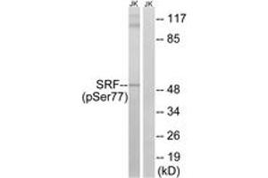 Western blot analysis of extracts from Jurkat cells treated with PMA 125ng/ml 30', using SRF (Phospho-Ser77) Antibody. (SRF antibody  (pSer77))