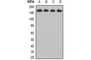 Western blot analysis of CCAR1 expression in Jurkat (A), HepG2 (B), A549 (C), A431 (D) whole cell lysates. (CCAR1 antibody)
