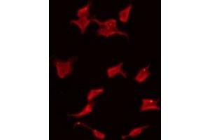 RASSF6 antibody  (Internal Region)