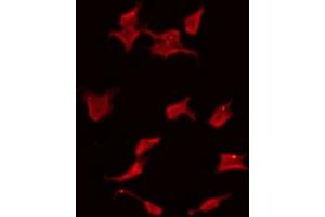 ABIN6275449 staining HeLa by IF/ICC. (RASSF6 antibody  (Internal Region))
