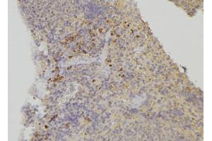 ABIN6278166 at 1/100 staining Human lymph node tissue by IHC-P.