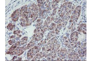 Immunohistochemical staining of paraffin-embedded Human pancreas tissue using anti-PPIL6 mouse monoclonal antibody. (PPIL6 antibody)
