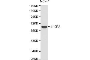 Western blot analysis of extracts of MCF-7 cell lines, using IL10RA antibody. (IL-10RA antibody  (AA 22-230))