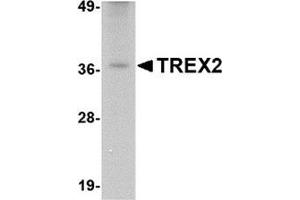 Western blot analysis of TREX2 in rat liver tissue lysate with this product at 2.