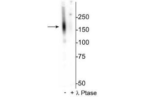 Western blot of mouse kidney lysate showing specific immunolabeling of the ~160 kDa NCC protein phosphorylated at Thr53 in the first lane (-). (SLC12A3 antibody  (pThr53))