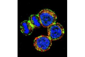 Confocal immunofluorescent analysis of BIRC3 Antibody (N-term) (ABIN657941 and ABIN2846885) with MDA-M cell followed by Alexa Fluor 488-conjugated goat anti-rabbit lgG (green). (BIRC3 antibody  (N-Term))