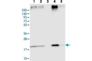 Western blot analysis of Lane 1: RT-4, Lane 2: U-251 MG, Lane 3: Human Plasma, Lane 4: Liver, Lane 5: Tonsil with TMEM205 polyclonal antibody .