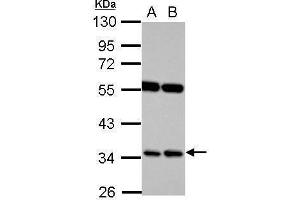 WB Image Sample (30 ug of whole cell lysate) A: Raji B: K562 10% SDS PAGE antibody diluted at 1:1000 (RASSF7 antibody  (Center))