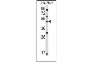 Western blot analysis of LDB1 Antibody (C-term) in ZR-75-1 cell line lysates (35ug/lane). (LIM Domain Binding 1 Protein antibody  (C-Term))
