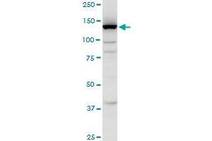 FLJ39155 polyclonal antibody (A01), Lot # 051024JC01. (EGFLAM antibody  (AA 914-1001))