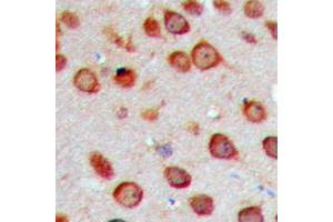 Immunohistochemical analysis of Cytochrome P450 2S1 staining in human brain formalin fixed paraffin embedded tissue section. (CYP2S1 antibody  (Center))