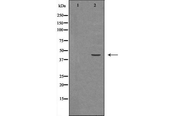 HSD3B2 antibody