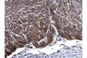 Immunohistochemistry (IHC) image for anti-Transcription Factor A, Mitochondrial (TFAM) antibody (ABIN2855585)