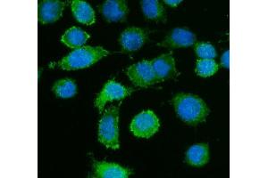 IF analysis of Caldesmon using anti-Caldesmon antibody (ABIN4886498). (Caldesmon antibody  (AA 1-120))