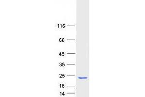 Western Blotting (WB) image for Anterior Gradient Homolog 2 (Xenopus Laevis) (AGR2) protein (Myc-DYKDDDDK Tag) (ABIN2714464)