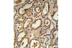 Formalin fixed and paraffin embedded human kidney tissue stained with DCP2 Antibody (Center) followed by peroxidase conjugation of the secondary antibody and DAB staining. (DCP2 antibody  (Middle Region))