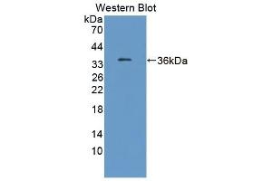 Detection of Recombinant TKT, Human using Polyclonal Antibody to Transketolase (TKT) (TKT antibody  (AA 1-294))