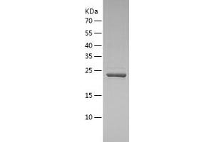 Western Blotting (WB) image for Phosphoribosylformylglycinamidine Synthase (PFAS) (AA 1064-1302) protein (His-IF2DI Tag) (ABIN7124445)